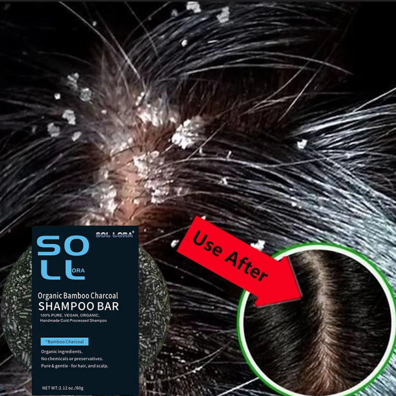 Sabonete de tratamento capilar - Hair Care Dandruff avaliação e preço